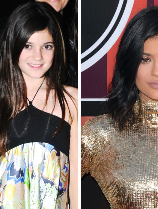 Se Kylie Jenner og hendes ekstreme skønhedsforvandling